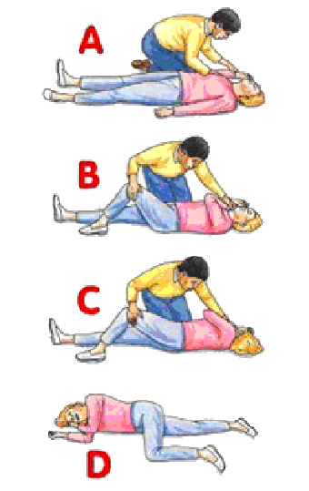 Figure 1 A basic life support sequence, 2007